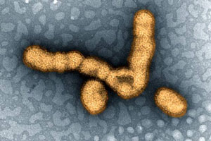 Colorized transmission electron micrograph showing H1N1 influenza virus particles.  Image: National Institute of Allergy and Infectious Diseases