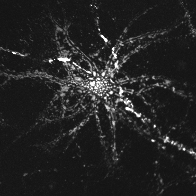 Crtl 1-Venus. Fusion of a fluorescent protein to small link proteins in the PNN allows tracking of PNN dynamics over time. Credit: S.F. Palida et al.