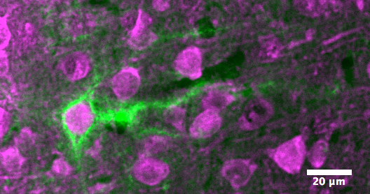 Crtl1-Venus Neurons. Tracking PNN dynamics in live cells, in mouse brain tissue. Credit: S.F. Palida et al.