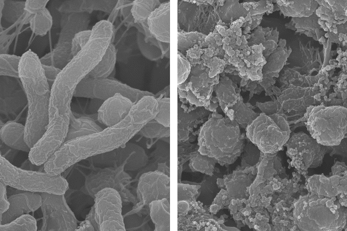 Большинство бактерий можно увидеть. Бактерии хеликобактер пилори микроскопия. Хеликобактер пилори микроскопия. Бактерия хеликобактер пилори микроскоп. Бактерия хеликобактер пилори под микроскопом.