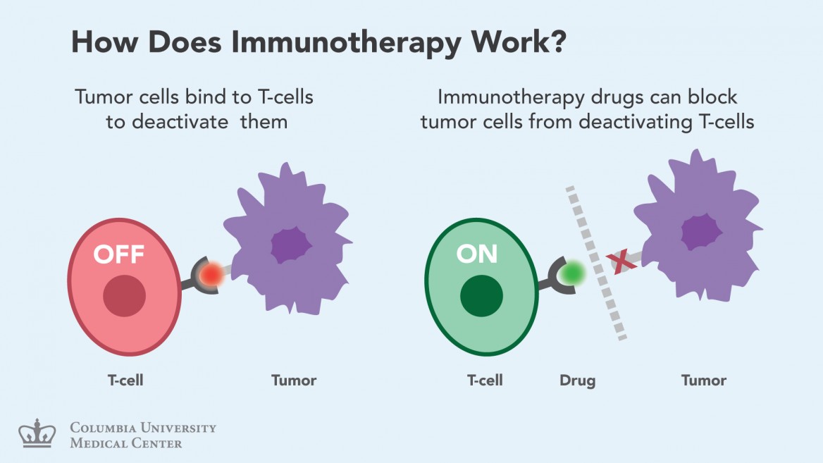 Cancer cells can bind to T-cells and “turn-off” their ability to detect and kill tumor cells. Immunotherapy drugs bind to T-cells and keep them “on” by blocking a tumor cell’s access to the T-cell. (Credit: Columbia University Medical Center)